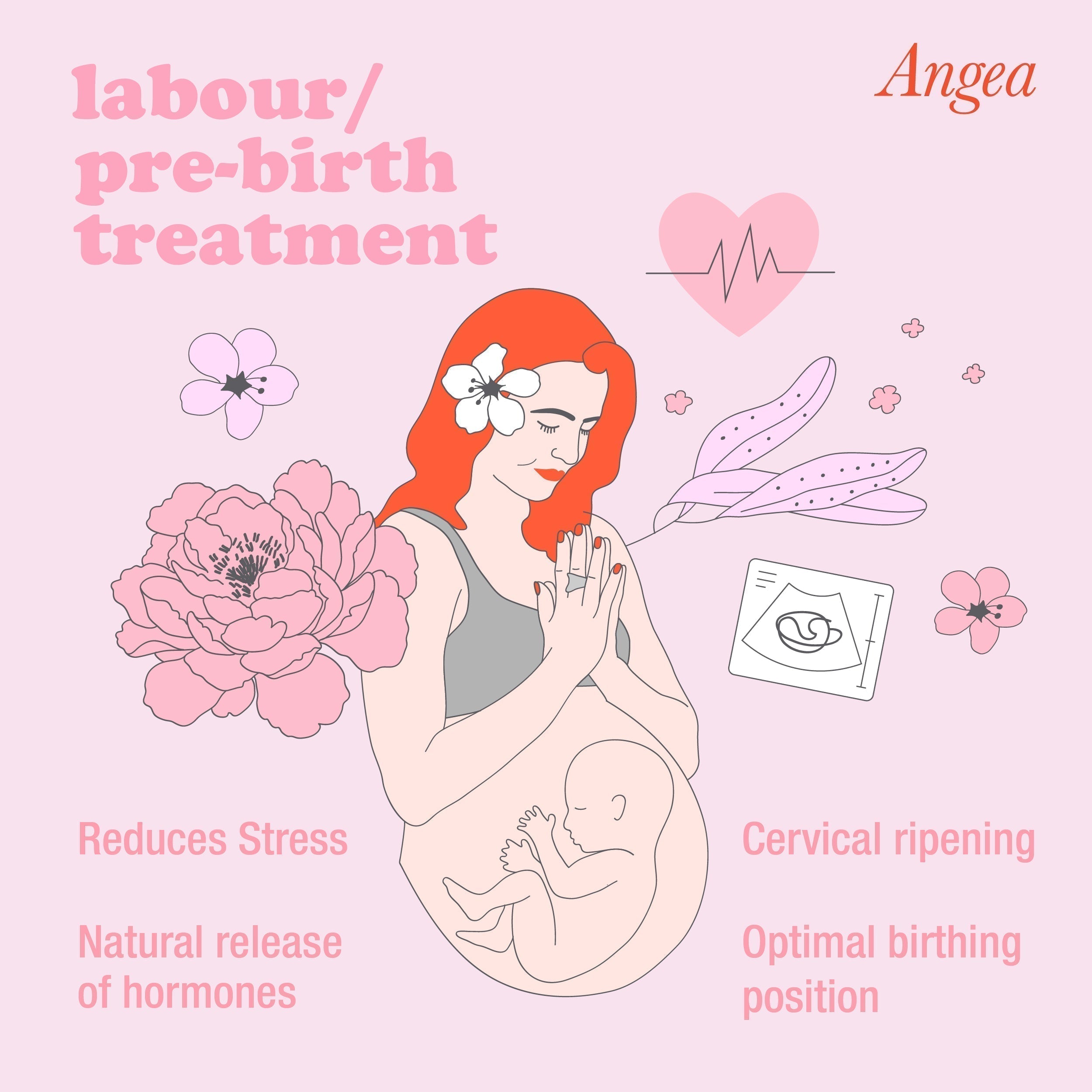 Pregnancy acupuncture illustration showing natural birth preparation, pain relief, relaxation, and maternal wellbeing.