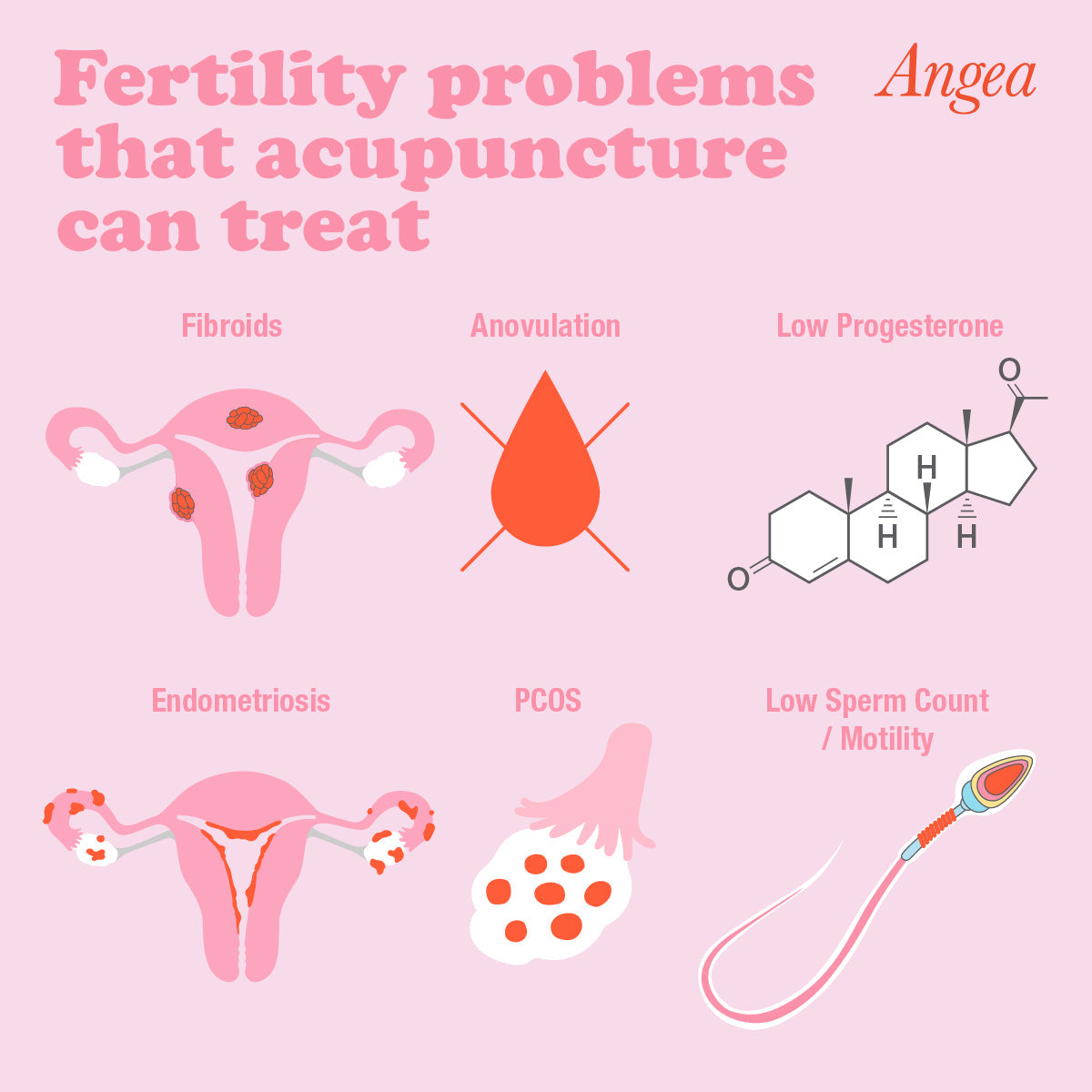 Acupuncture treatment illustration showing how acupuncture may help support fertility, ovulation, hormone balance, and reproductive health.