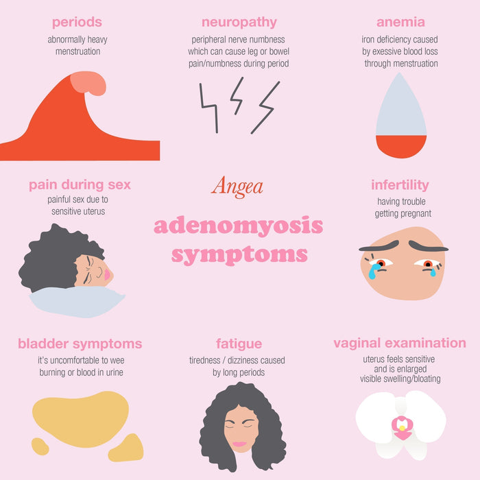 Medical illustration explaining adenomyosis, its effects on the uterus, menstrual pain, heavy bleeding, and women's reproductive health.