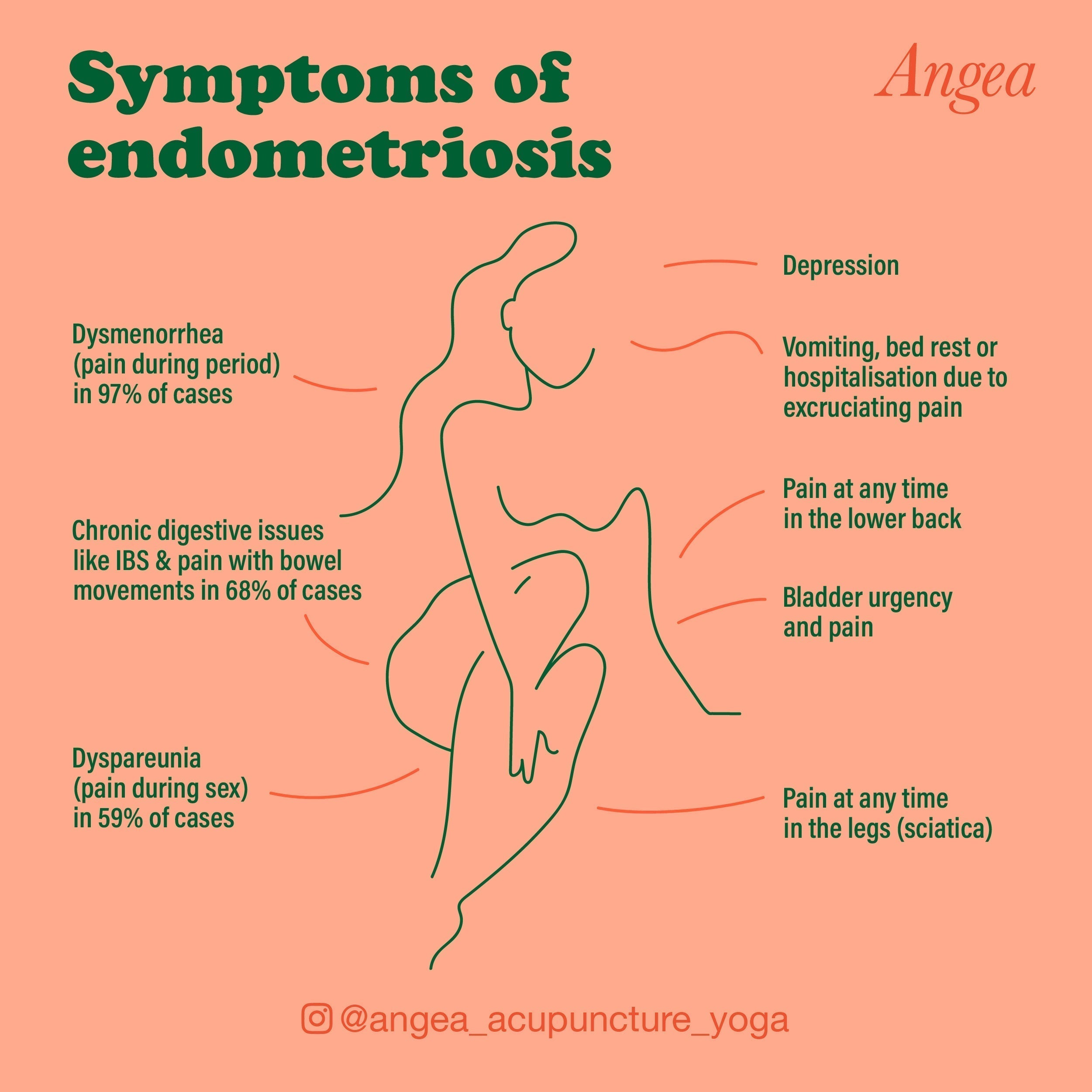 Educational infographic explaining the common symptoms of endometriosis, including pelvic pain, painful periods, infertility, and digestive issues.