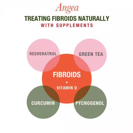 Educational infographic about natural ways to manage uterine fibroids through nutrition, lifestyle, hormone balance, and holistic care.