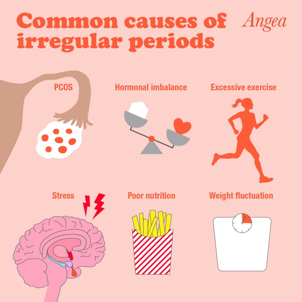 Educational illustration explaining the common causes of irregular periods, including hormone imbalance, PCOS, stress, thyroid disorders, and lifestyle factors.