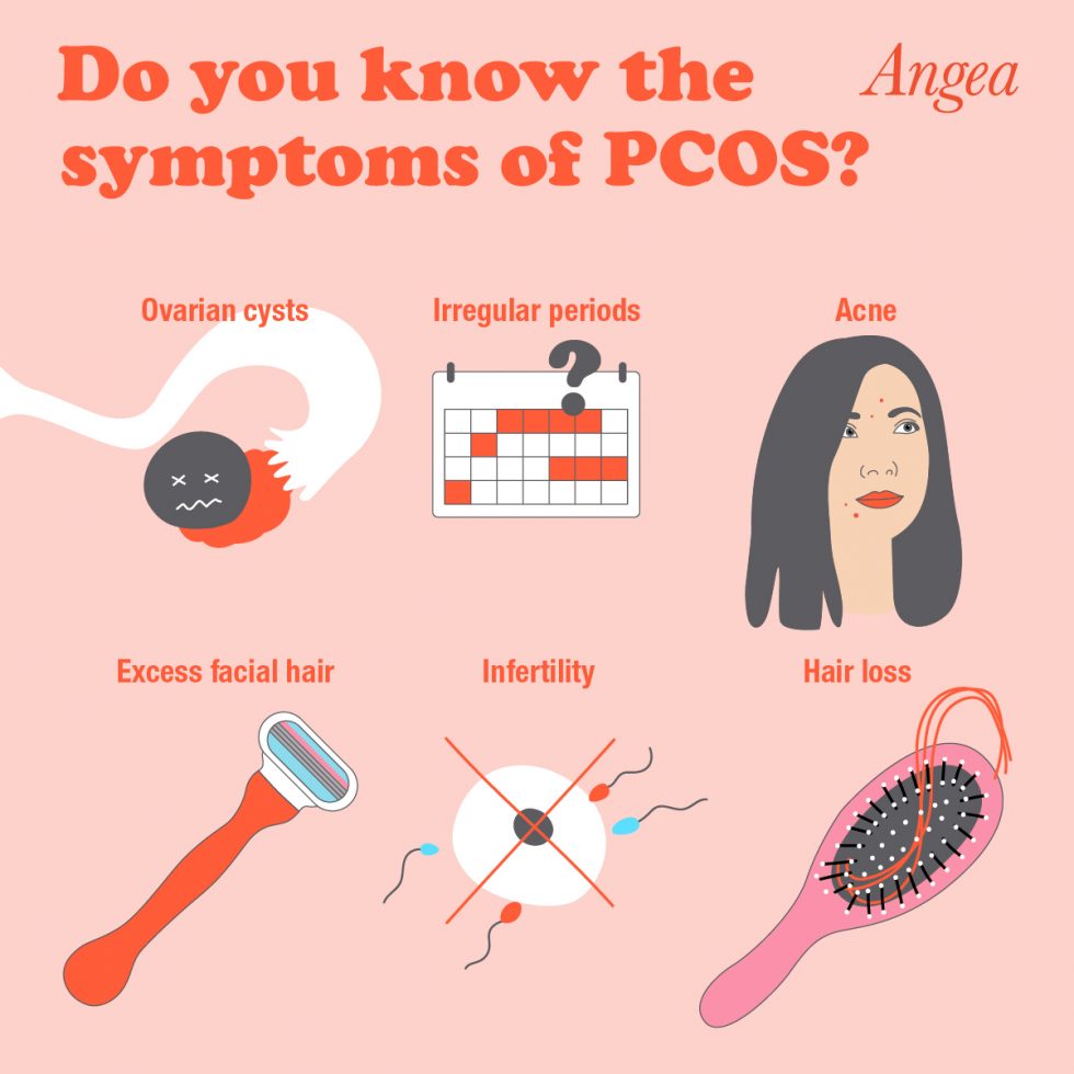 Infographic explaining the common symptoms of PCOS, including irregular periods, acne, excess hair growth, weight changes, infertility, and hormone imbalance.